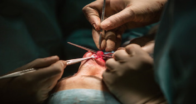 روش های جراحی زیبایی بینی استخوانی