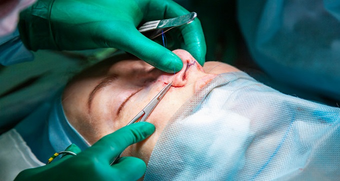 مراحل جراحی بینی 