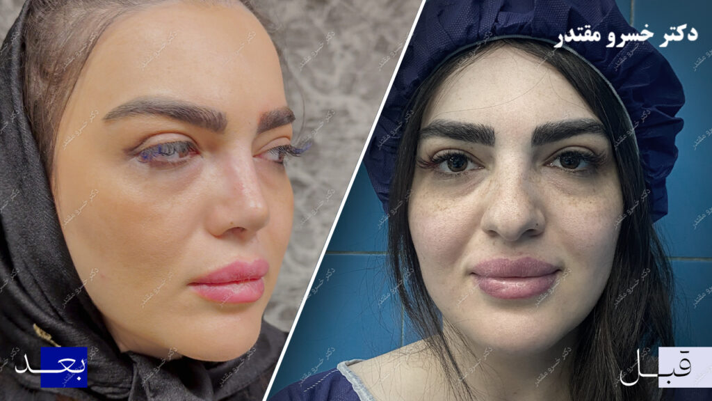 نمونه عمل جراحی 4