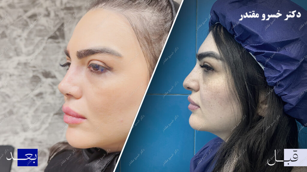 نمونه عمل جراحی 5