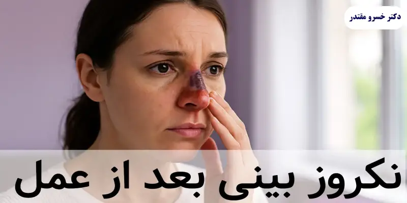درمان نکروز بینی
