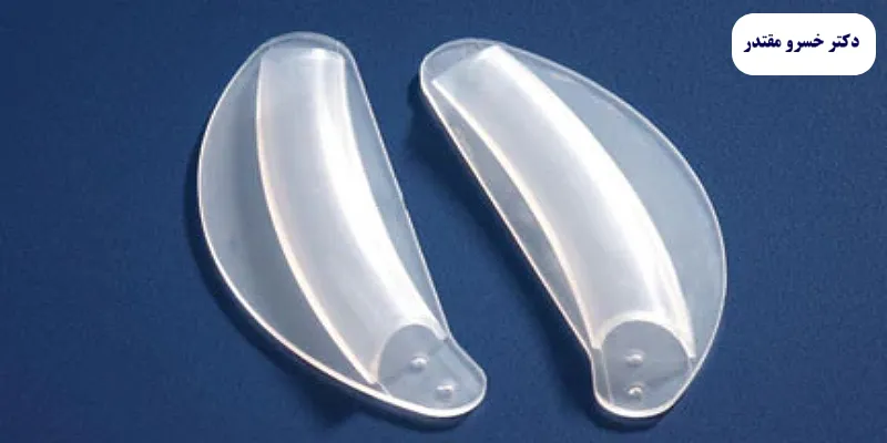 اسپلینت بینی خارجی