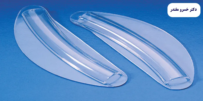 انواع اسپلینت بینی