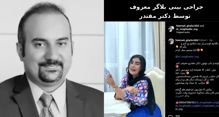  عمل بینی فاطمه غفوری توسط دکتر خسرو مقتدر