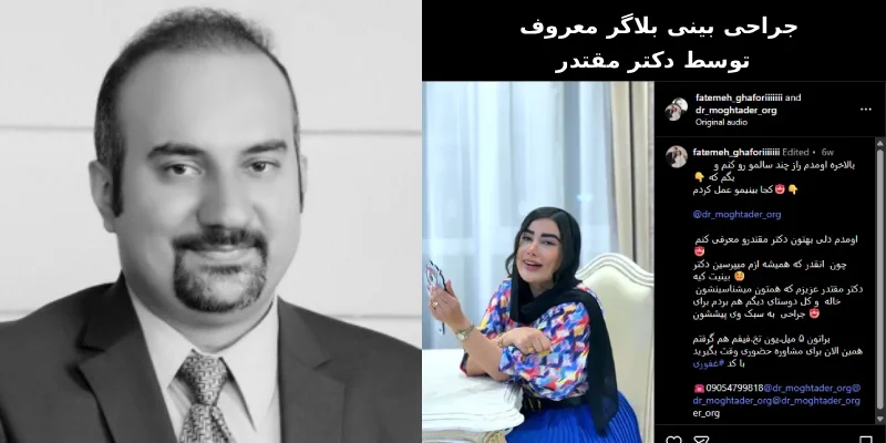 جراحی بینی بلاگر معروف توسط دکتر مقتدر