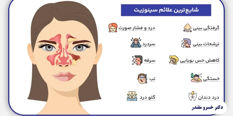 تخلیه سینوزیت