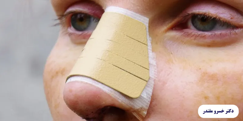 مواد غذایی مکمل برای تقویت غضروف بینی