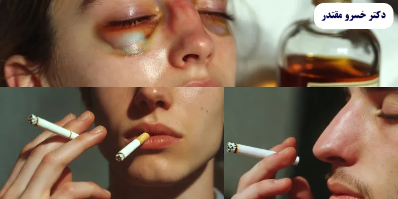 مصرف الکل و سیگار بر جراحی بینی