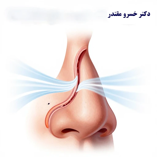 معاینه بینی توسط پزشک متخصص